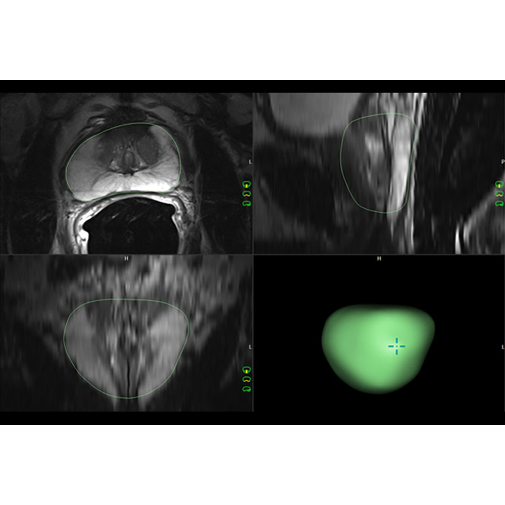 Invivo DynaCAD Prostate Invivo DynaCAD Prostate